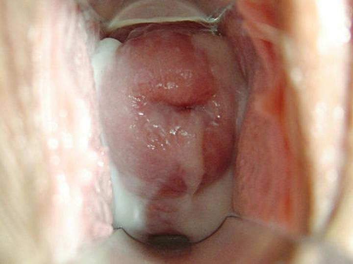 Smak i właściwości śluzu pochwy